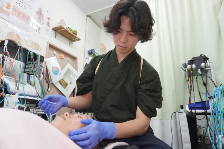 【整体】医学的知見に基づく美容鍼の無料提供in浅草橋